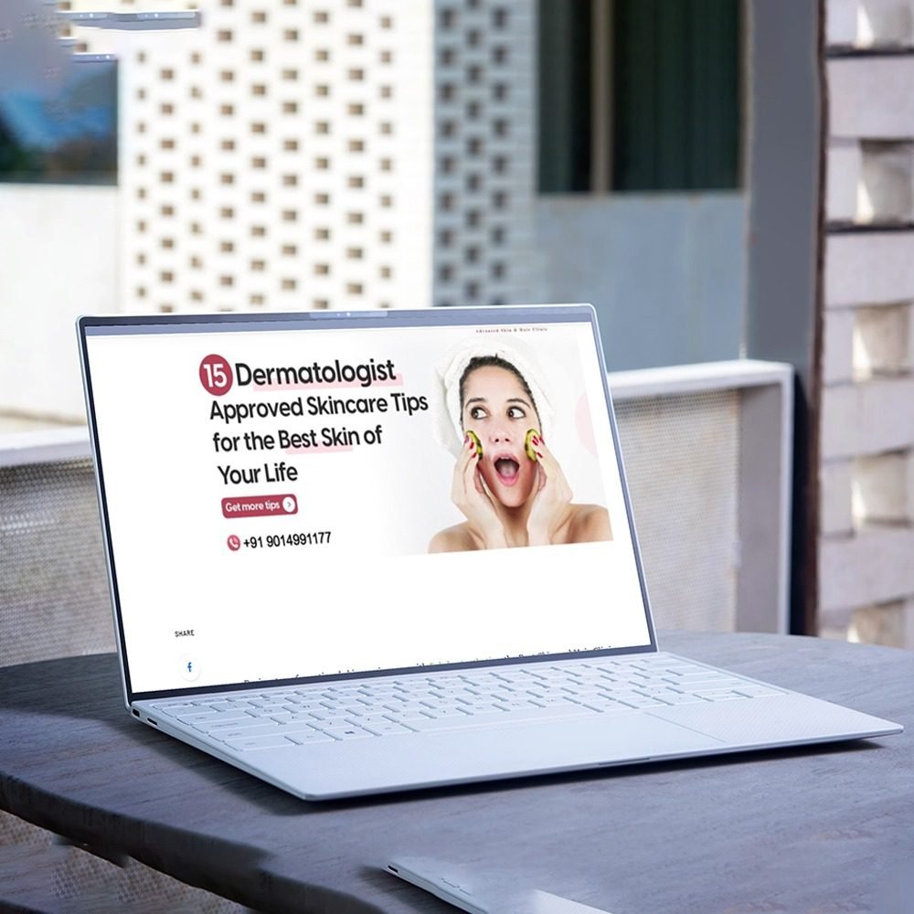 Laptop screen displaying 15 dermatologist-approved skincare tips for glowing skin, featuring a surprised woman and contact number of a Hyderabad skincare clinic.